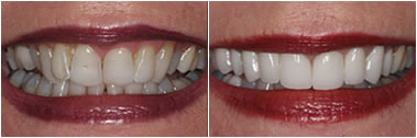 Cosmeticdentistry2